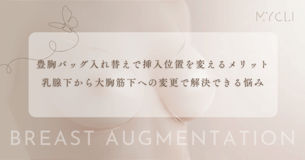 豊胸バッグ入れ替えで挿入位置を変えるメリット｜乳腺下から大胸筋下への変更で解決できる悩み