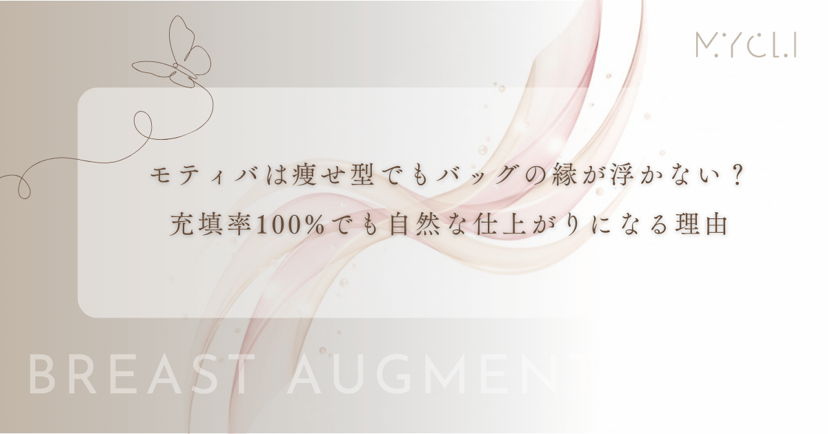 モティバは痩せ型でもバッグの縁が浮かない？充填率100%でも自然な仕上がりになる理由