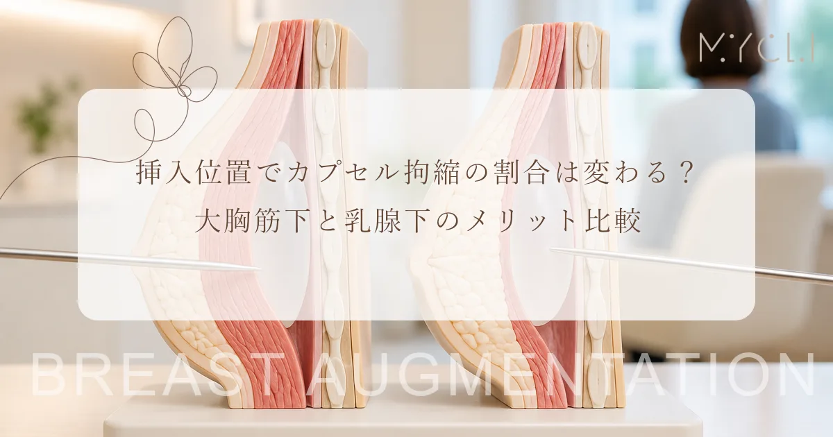 挿入位置でカプセル拘縮の割合は変わる?大胸筋下と乳腺下のメリット比較