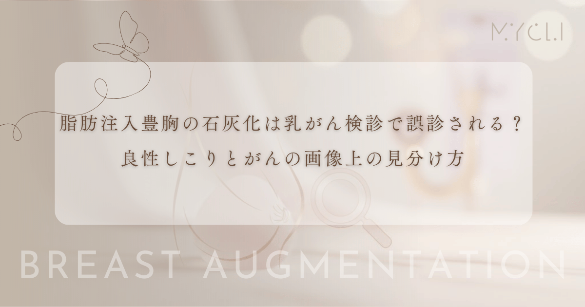 脂肪注入豊胸の石灰化は乳がん検診で誤診される？良性のしこりとがんの画像上の見分け方