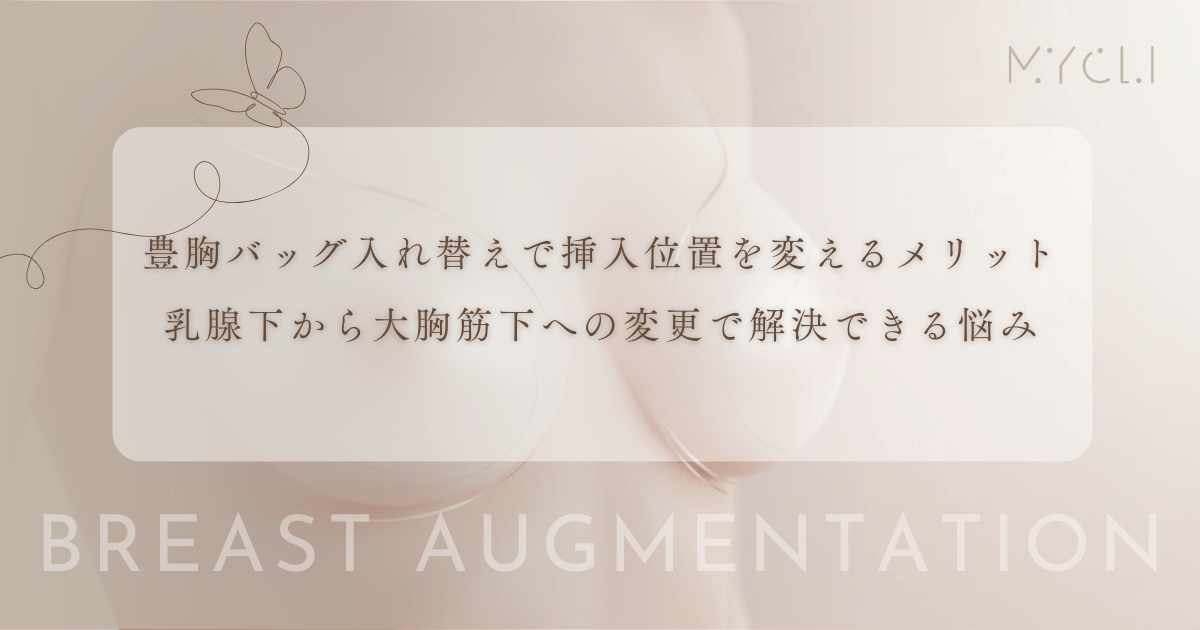 豊胸バッグ入れ替えで挿入位置を変えるメリット｜乳腺下から大胸筋下への変更で解決できる悩み
