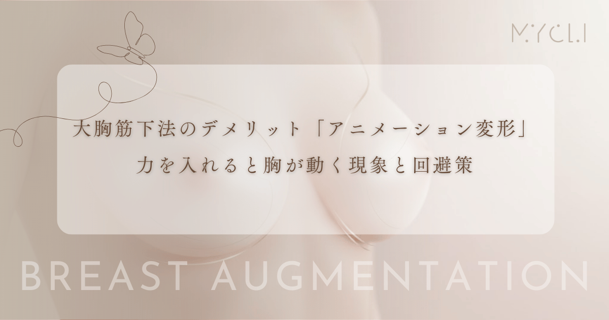 大胸筋下法のデメリット「アニメーション変形」とは?力を入れると胸が動く現象と回避策