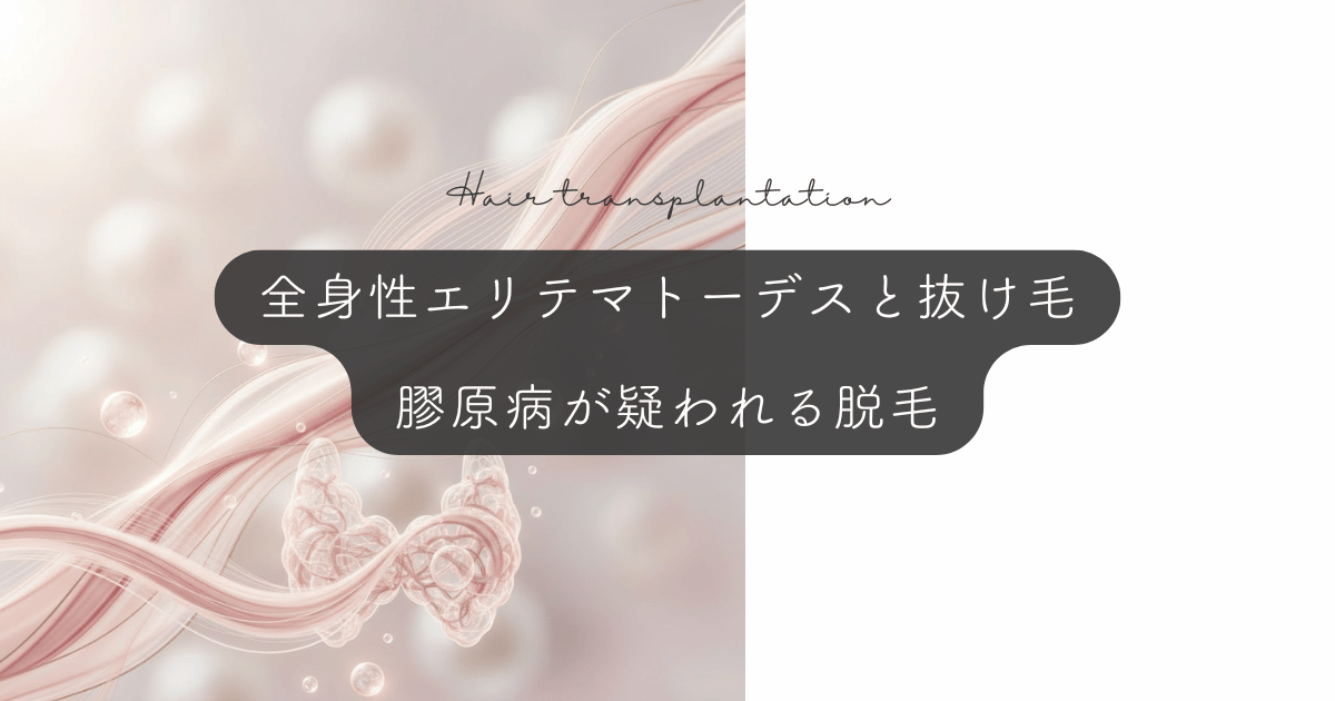 全身性エリテマトーデス（SLE）と抜け毛｜膠原病が疑われる大量脱毛